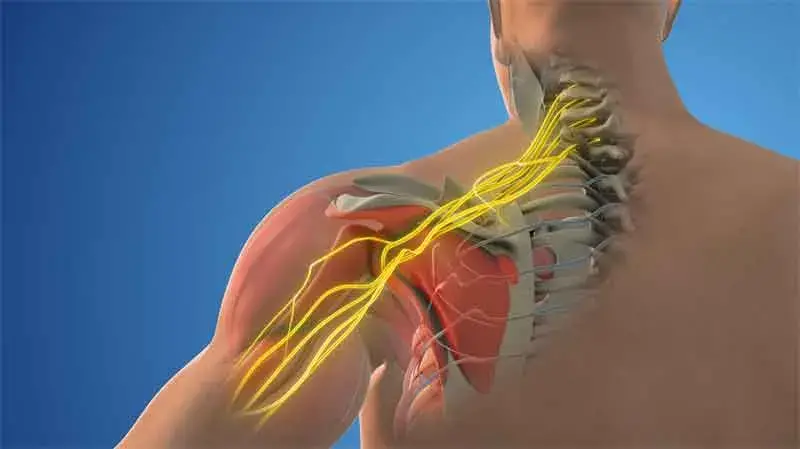 Brachial Plexus Surgery by Dr. Dharmesh JB in Bangalore