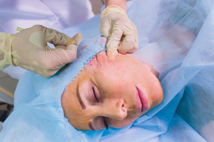 Facial fat grafting treatment in Bangalore by Dr. Dharmesh JB