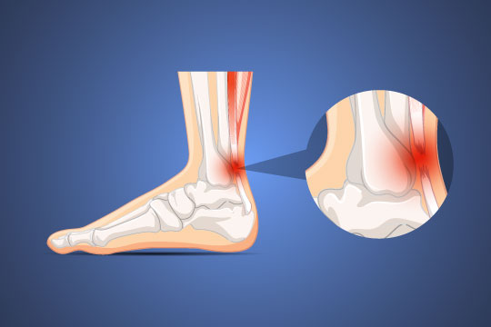 Hand Fracture and Joint Injury Treatment by Dr. Dharmesh JB in Bangalore